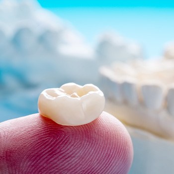 Dental crown treatment can vary in cost from patient to patient