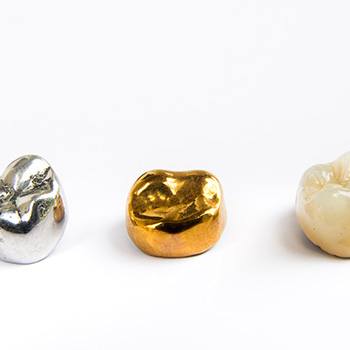 Factors that affect the cost of your dental crown include the material the crown is made of