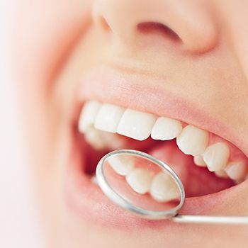 Nose-to-mouth closeup of someone’s teeth in a dental mirror