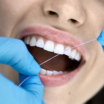 Gloved hands flossing a patient’s teeth
