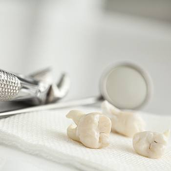 Sever teeth on tray after extraction