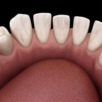 Animated smile with gaps between teeth