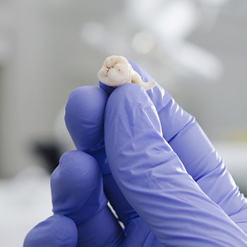 Hand holding an extracted tooth