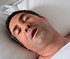 Snoring man in need of sleep apnea therapy